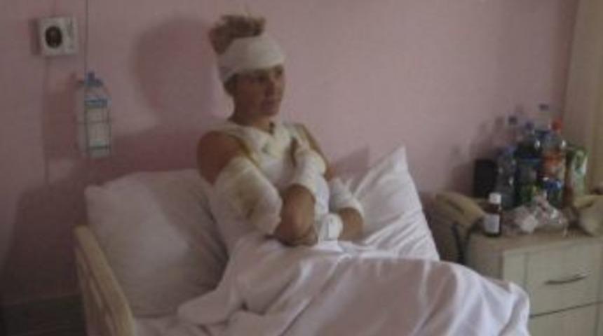 Ateşte Balık, Turistleri Yaktı