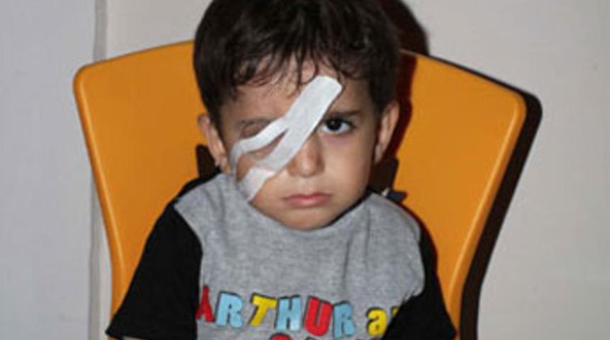 Patlayan şişe k&ouml;r etti