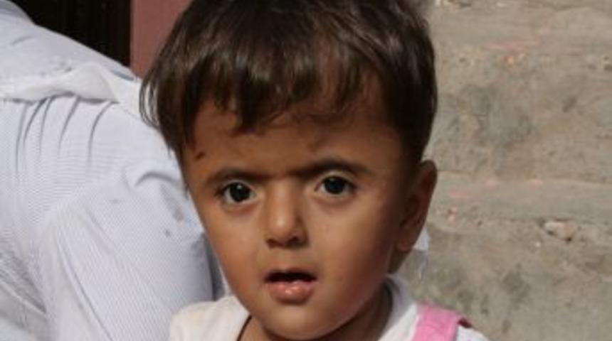 Kafası sürekli büyüyor