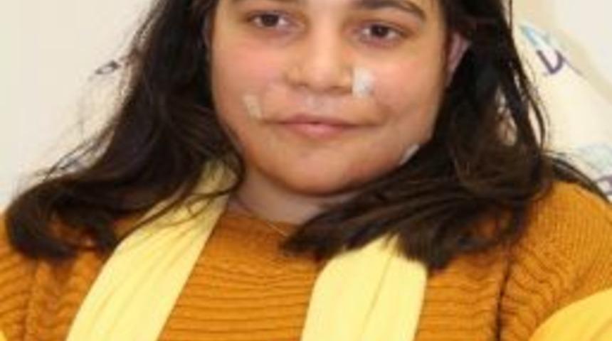 Y&uuml;z&uuml;ne Kezzap Atılan Afgan Kız, Eski G&ouml;r&uuml;n&uuml;m&uuml;ne Yeniden D&ouml;nd&uuml;