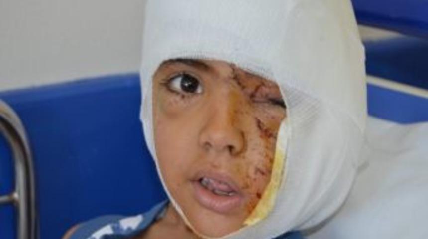 Rotweiler, 5 Yaşındaki &Ccedil;ocuğu Su İ&ccedil;erken Par&ccedil;aladı