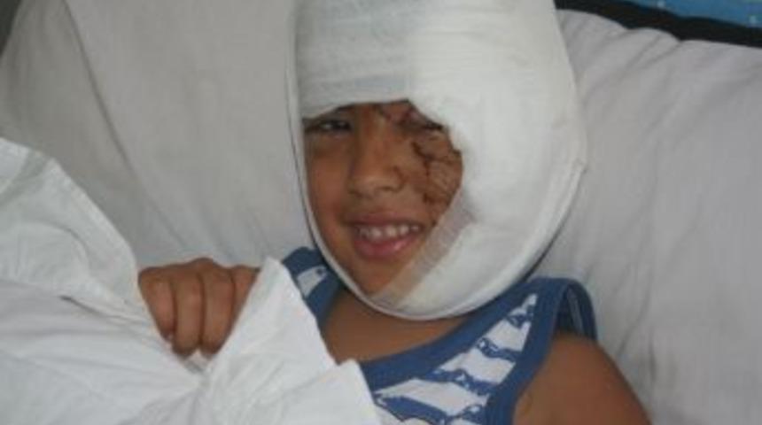 K&ouml;pek 5 yaşındaki &ccedil;ocuğu par&ccedil;aladı