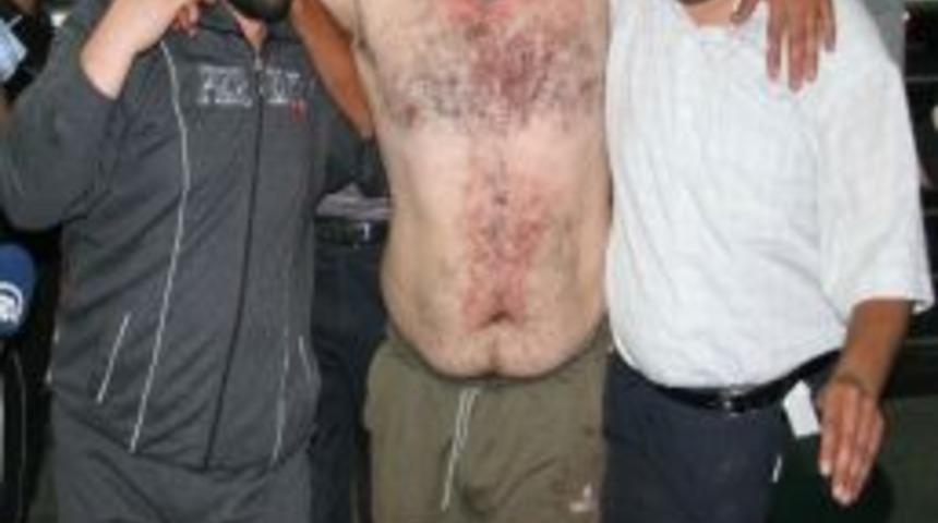 Yaralı 2 Suriyeli T&uuml;rkiye'ye Getirildi