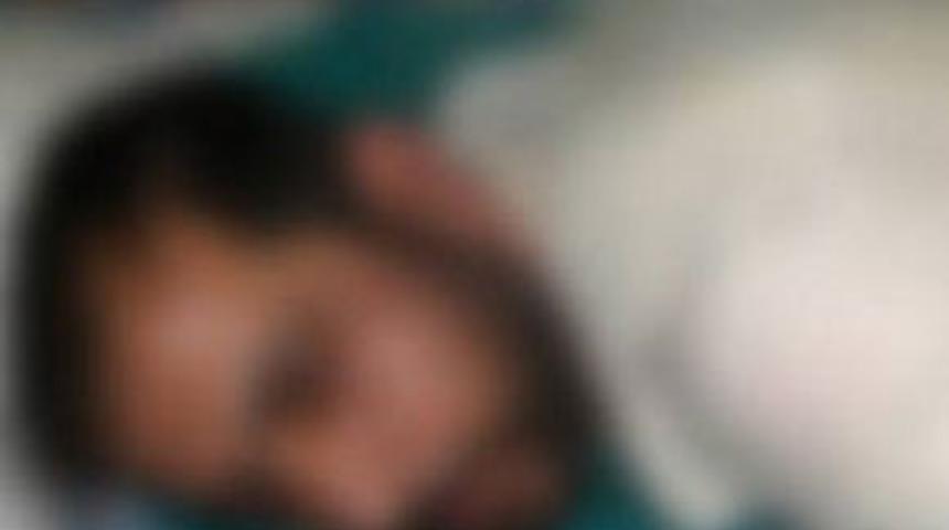 Eşini kızgın yağla yaktı