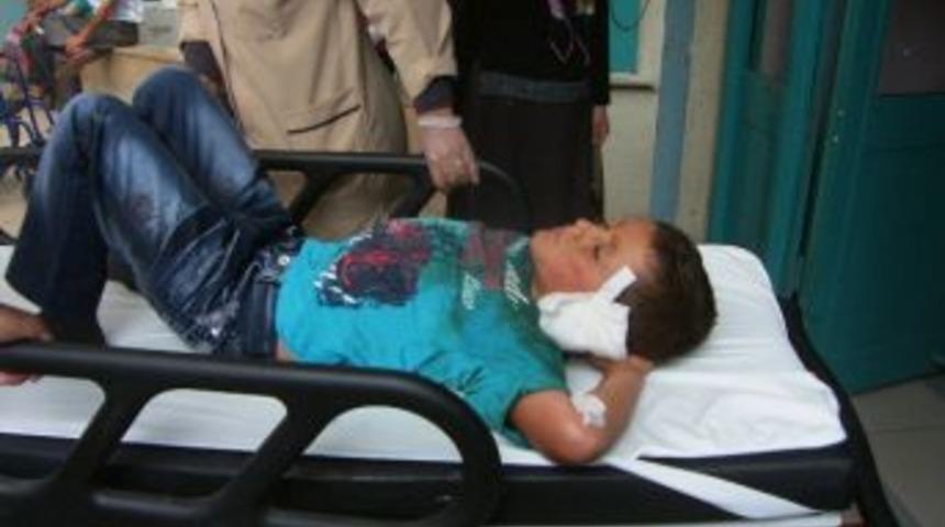 Kuru Sıkı Silahla Yaralandı