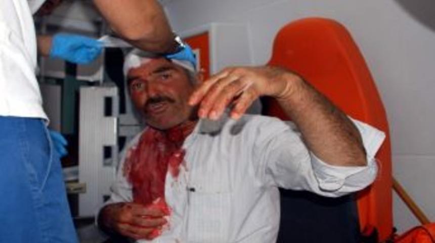 Adıyaman&rsquo;da Arazi Kavgası : 1 Yaralı