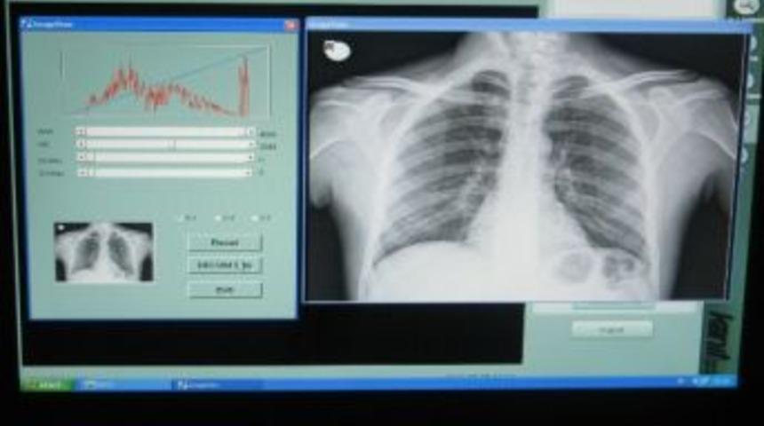 R&ouml;ntgen Sırası Ve Hatası Tarih Oldu