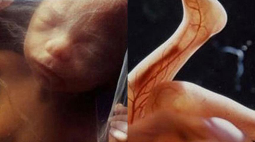 Anne karnındaki bebeğin mucize g&ouml;r&uuml;nt&uuml;leri