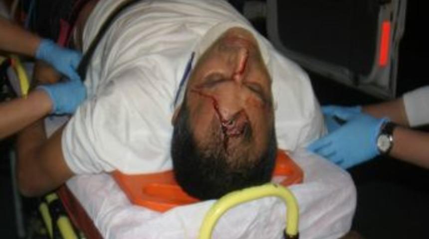 Otomobil Ağaca &Ccedil;arptı: 1 Yaralı