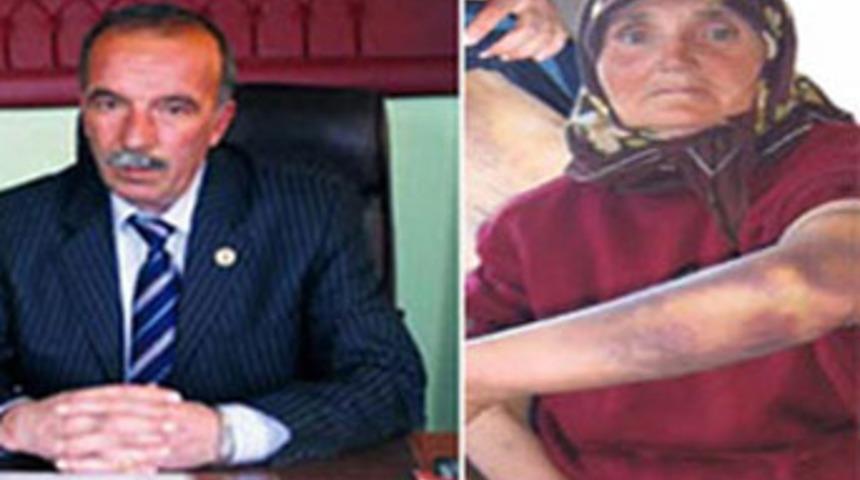 Belediye Başkanı, sopayla vatandaşı d&ouml;vd&uuml;
