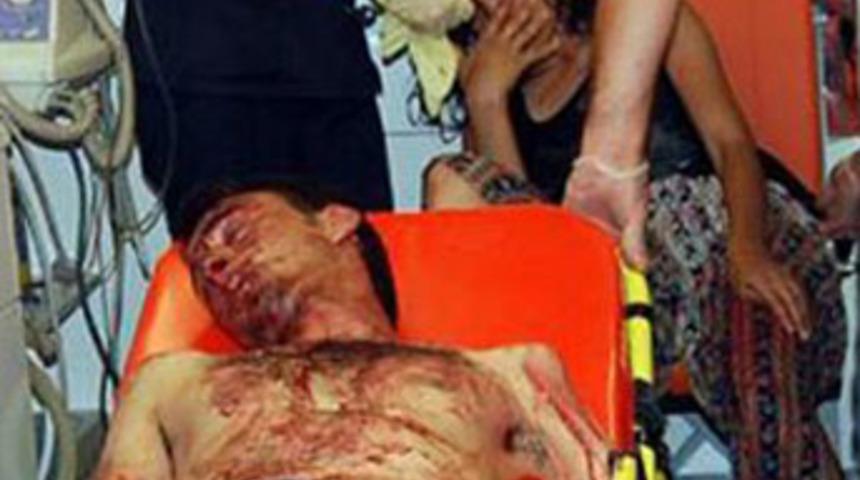 Misafirle seks kavgası