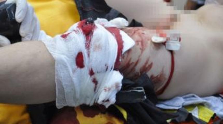 Bacağına demir &ccedil;ubuk saplandı