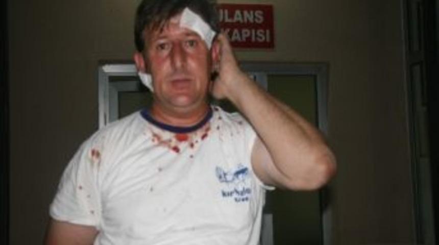 25 Tl İ&ccedil;in Kan Aktı