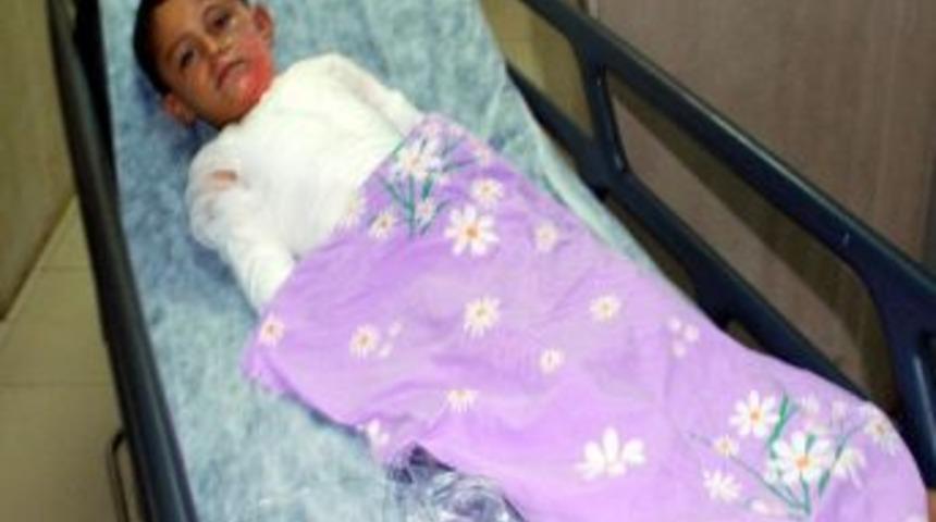 &Uuml;zerlerine Kaynar Su D&ouml;k&uuml;len İki Kardeş Ağır Yaralandı