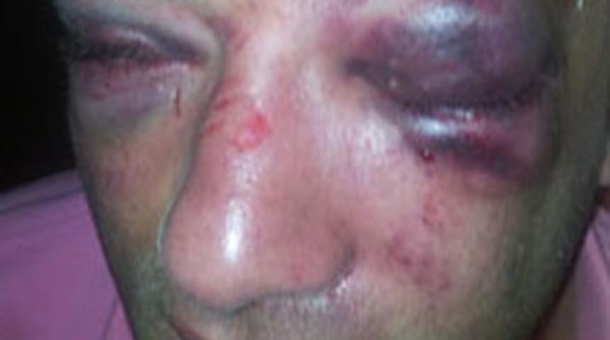 Polis dayağı iddiası