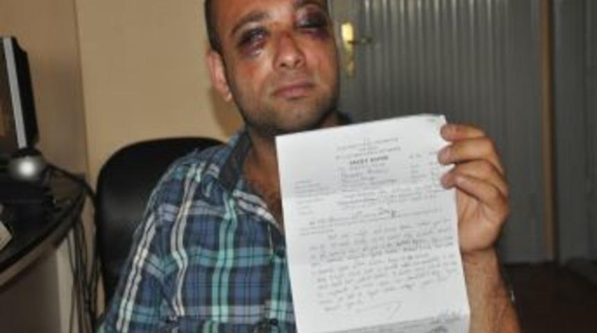 Trabzon&rsquo;da Polisten Vatandaşa Dayak İddiası