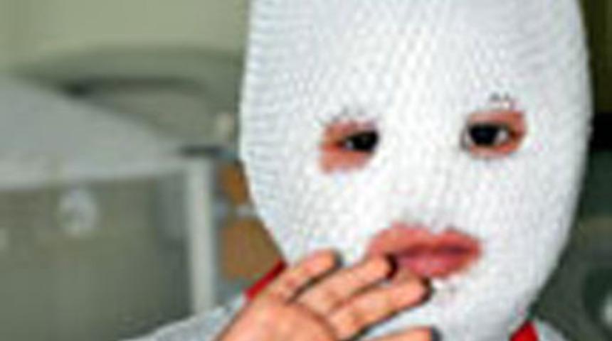 S&uuml;t dolu tencere y&uuml;z&uuml;n&uuml; yaktı