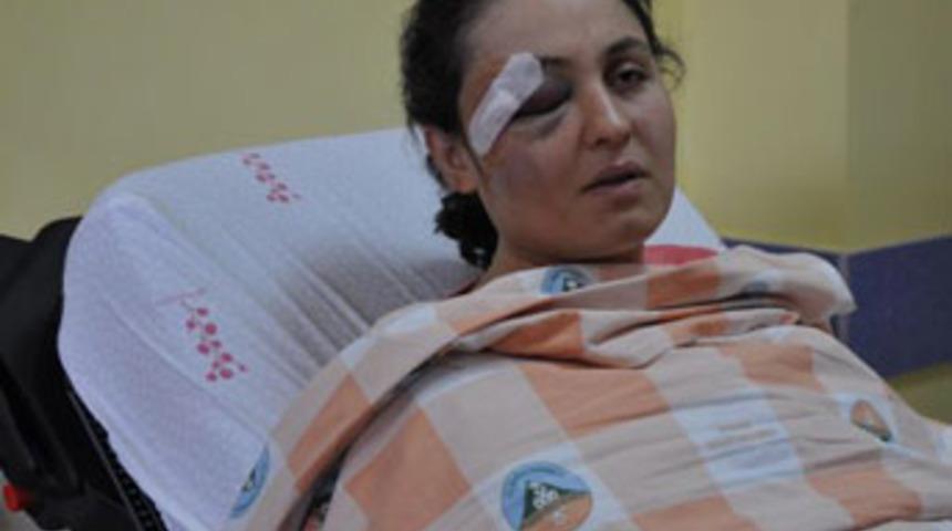 Genç kadına aile boyu dayak