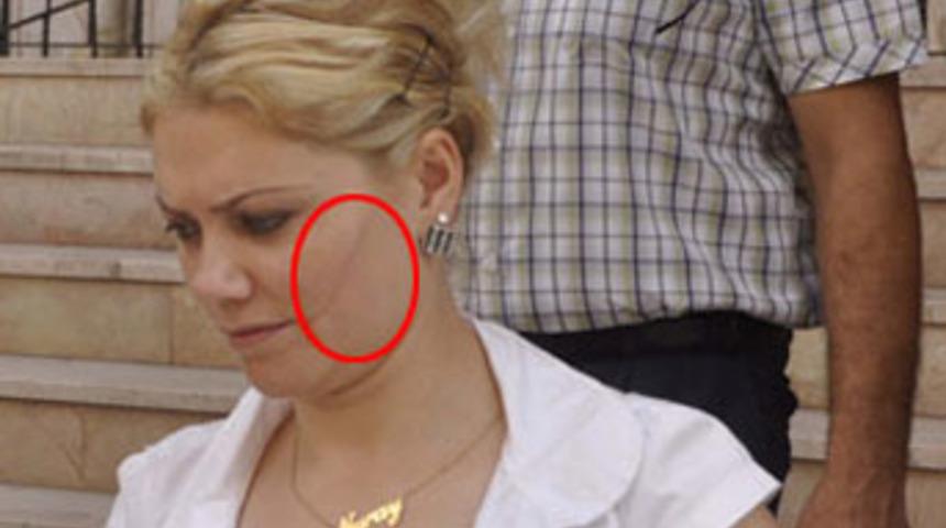 Karısının yüzünü kesti