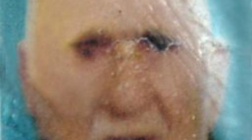 Balkondan Düşen Yaşlı Şahıs Öldü