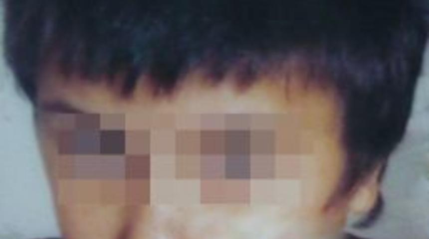 Yanlışlıkla Sinek İlacı İ&ccedil;en Zihinsel &Ouml;z&uuml;rl&uuml; Kız Kurtarılamadı