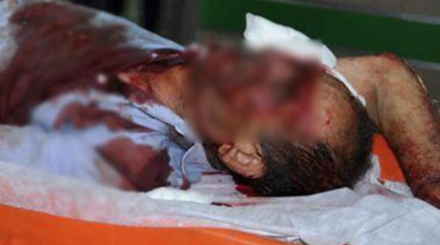 Sidik kavgası kanlı bitti