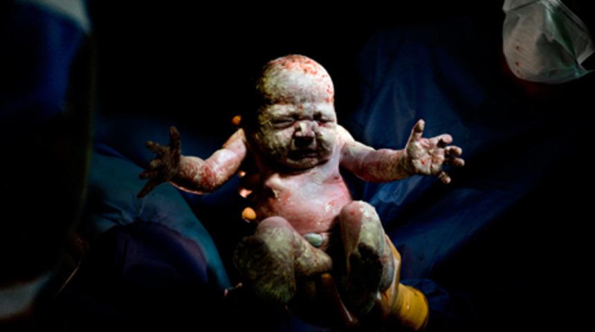 Bebeğin d&uuml;nyaya g&ouml;zlerini a&ccedil;tığı ilk saniyeler