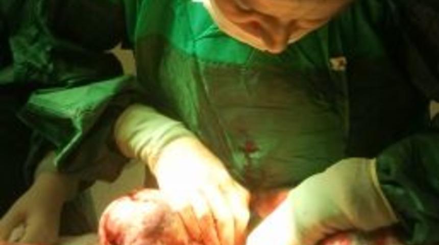 Halsizlik Diye Gitti, G&ouml;bek &Uuml;st&uuml;nde 4 Kilo Miyom &Ccedil;ıktı