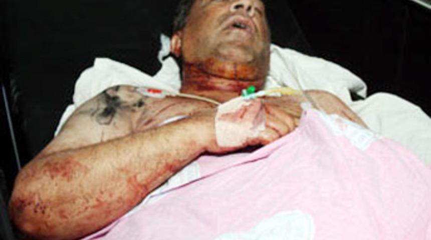 Kızını &ouml;ld&uuml;rd&uuml;, kendi boğazını kesti