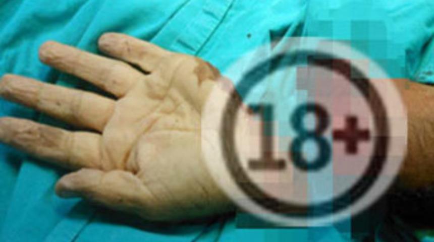 Kopan elini bırakıp ka&ccedil;tı!