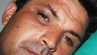 Jandarma karakolunda dayak iddiası!