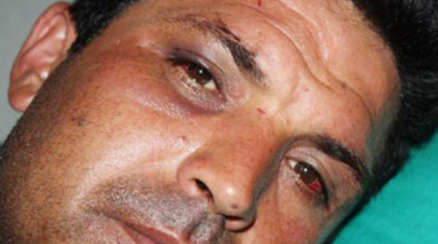 Jandarma karakolunda dayak iddiası!