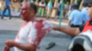 Kıskançlık krizi bir can aldı