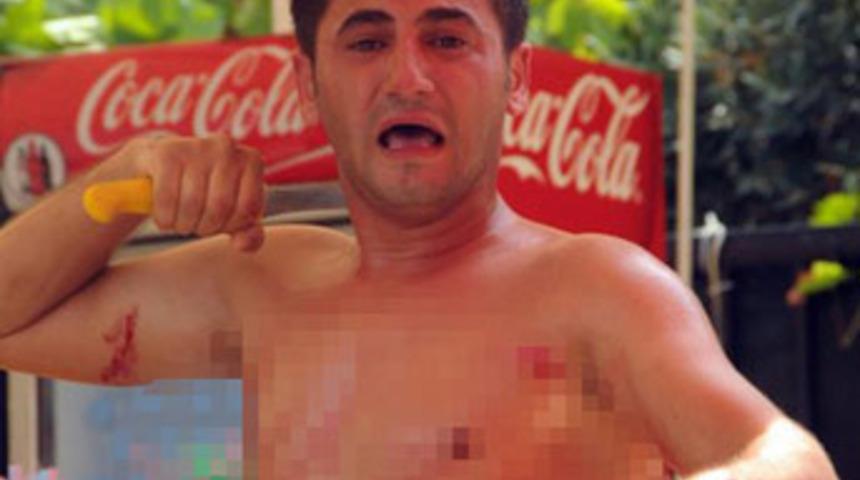 Bir saat boyunca kendini doğradı