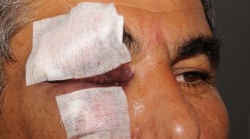 Alkoll&uuml; Şahıs 112 Acil Servis Şof&ouml;r&uuml;n&uuml; Darp Etti