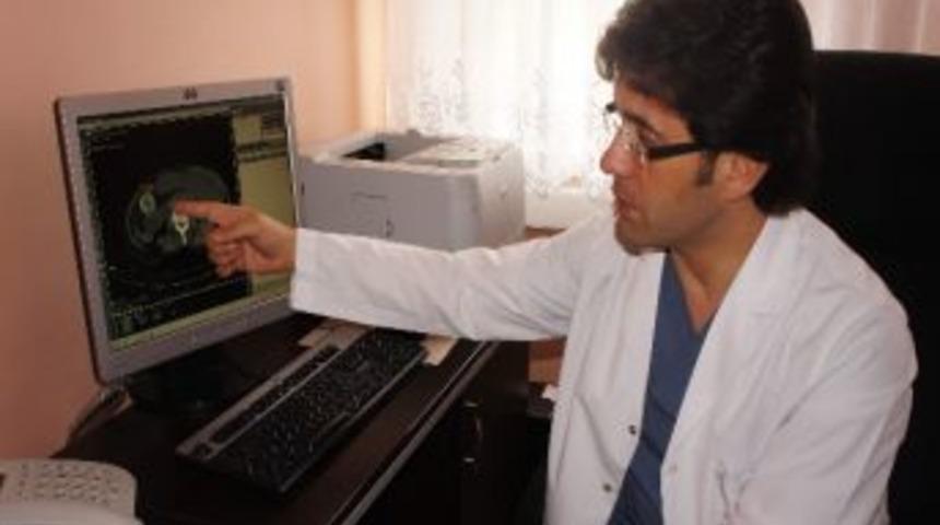 Bağırsaklarını Tıkayan Taş Ameliyatla Alındı