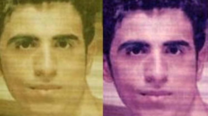 'Kansersin' dediler sağlıklı organını aldılar