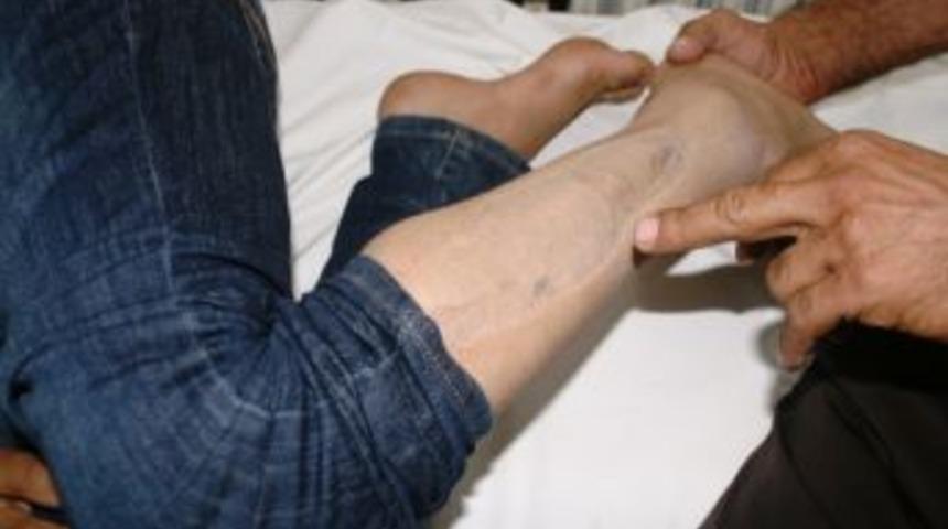 Iğdır&rsquo;da Yılan Tarafından 2. Kez Isırılan Gen&ccedil; Kızın Kabusu