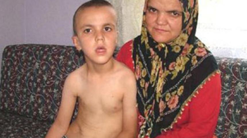 7 yaşında 14. kez ameliyat olacak