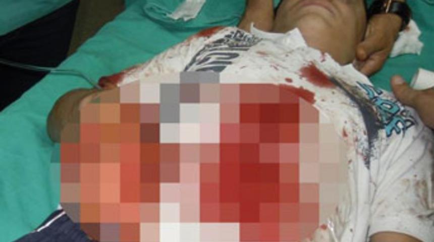 Polise atmak istediği bomba elinde patladı