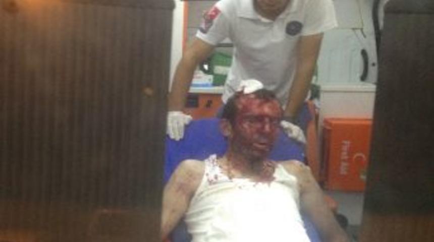 Otel odasını basarak öldüresiye dövdüler