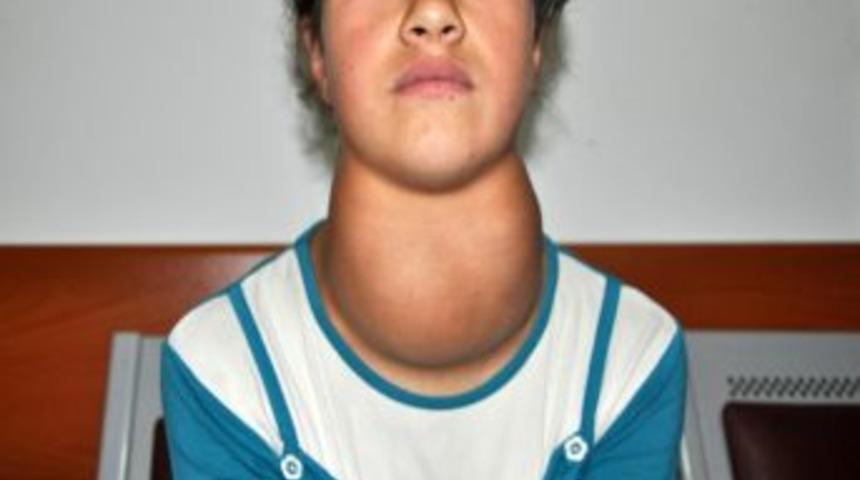 Guatrın Ana Sebebi Iyot Eksikliği Ve Genetik Fakt&ouml;rler