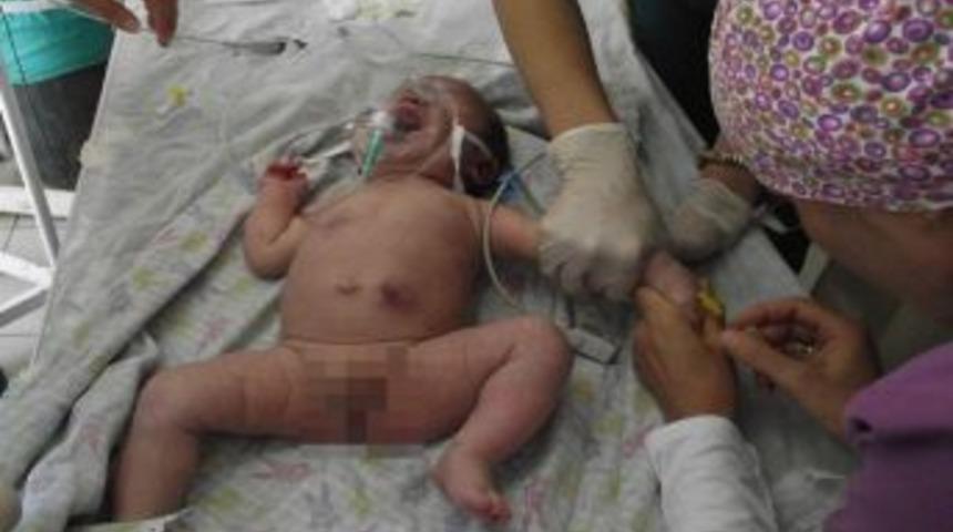 42 g&uuml;nl&uuml;k bebeği ısırıp hastanelik etti