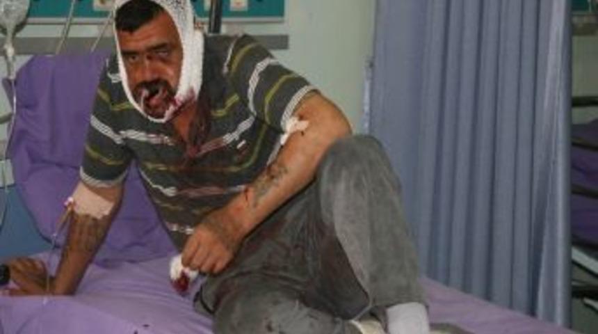 Suriye&rsquo;den Yaralı Sirk&uuml;lasyonu S&uuml;r&uuml;yor