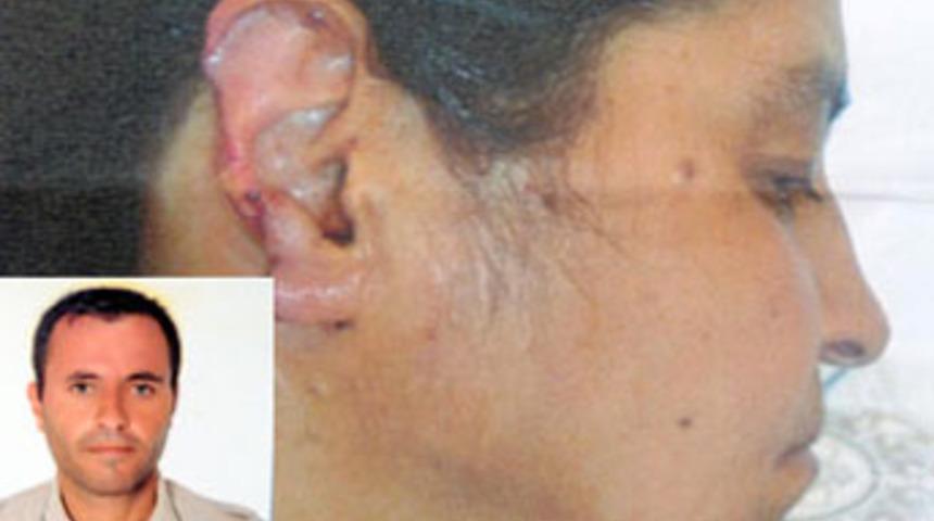 Karısının kulağını kopartıp &ccedil;iğnedi