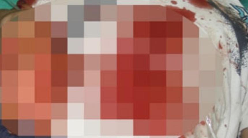 Arazide buldukları cisim patladı: 1 &ouml;l&uuml;