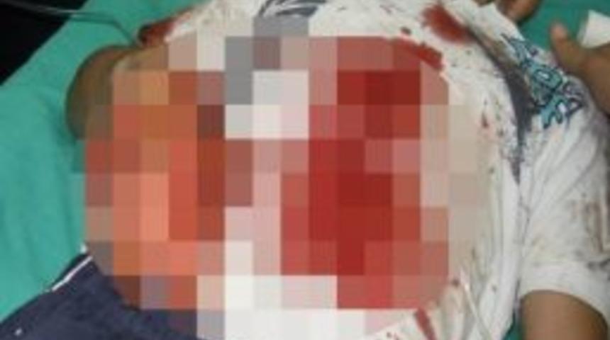 Bombacı &Ccedil;ocuk Serbest Kaldı