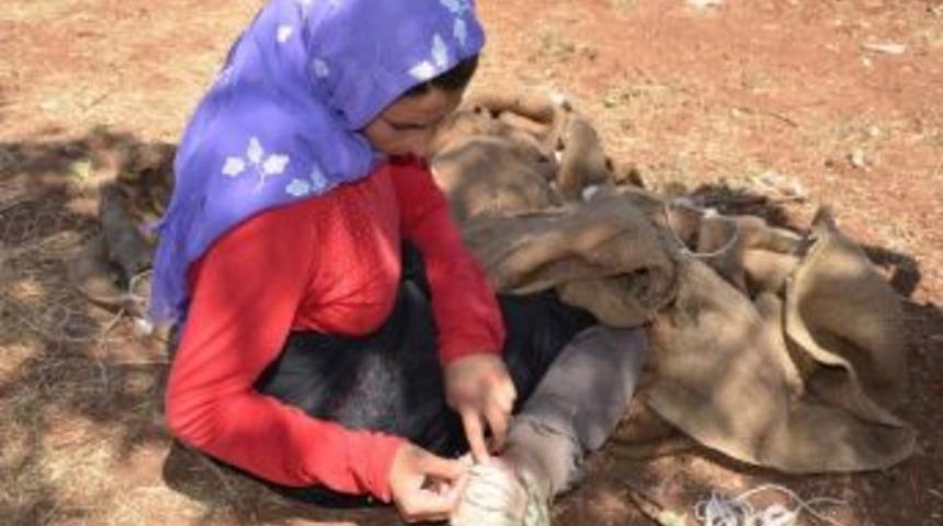 Ayağında Kurt&ccedil;uklar Oluşan Gen&ccedil; Kız Yardım Bekliyor