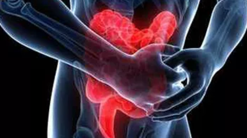 İnflamatuvar bağırsak hastalığı nedir?  İnflamatuvar bağırsak hastalığı tedavisi nasıl ger&ccedil;ekleşir?