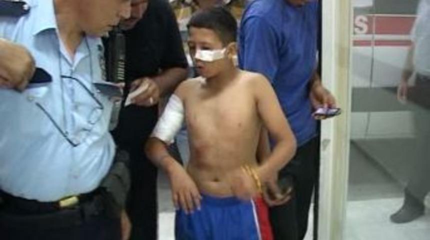 Eve Sıkılan Kurşunlar Balkondaki &Ccedil;ocuğu Yaraladı